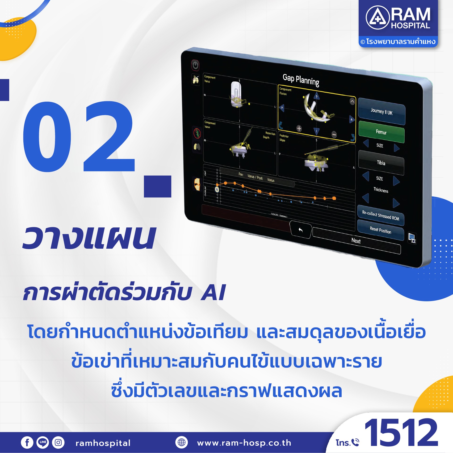 ผ่าตัดข้อเข่าเทียมด้วยหุ่นยนต์
