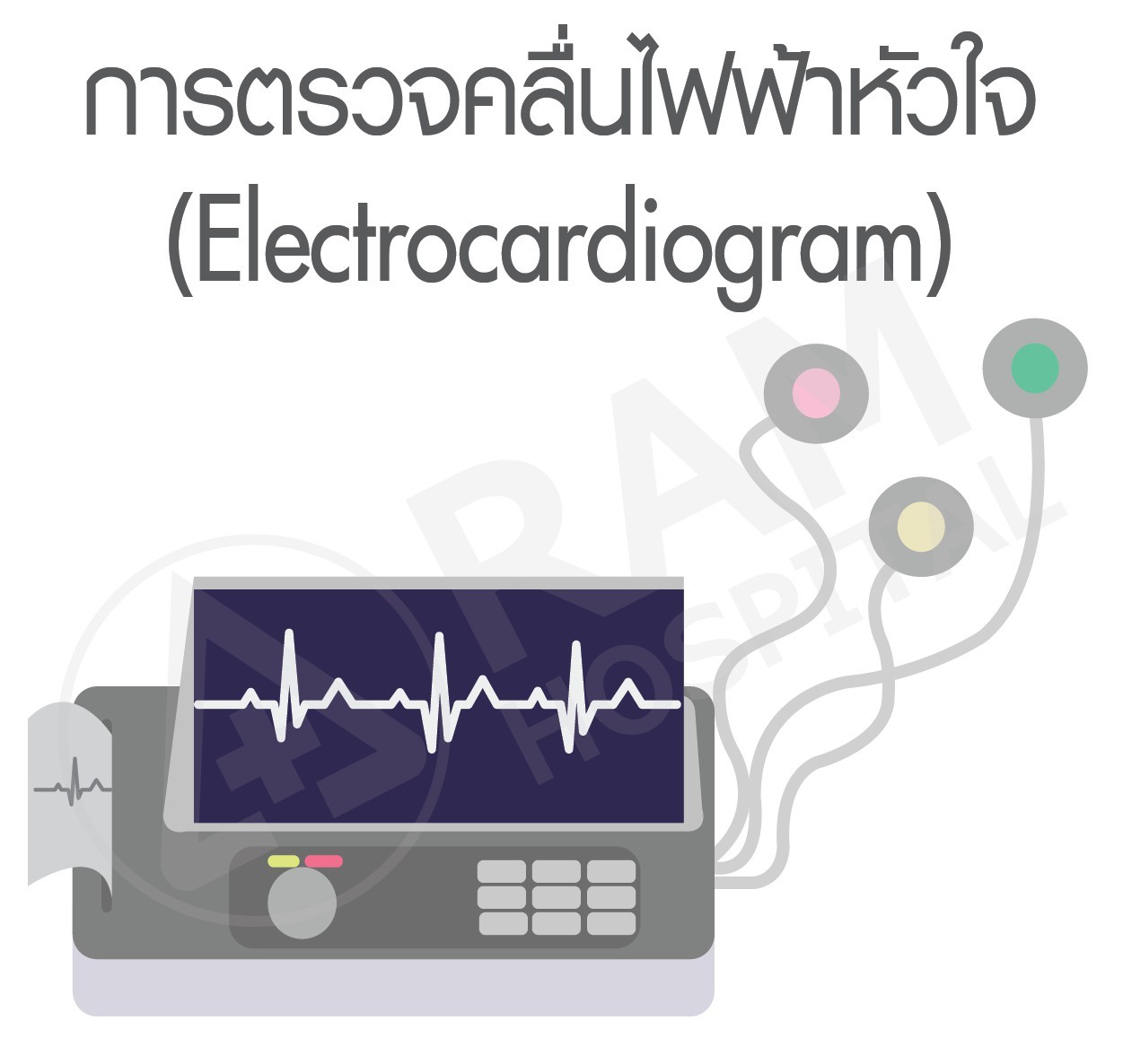 ตรวจคลื่นไฟฟ้าหัวใจ