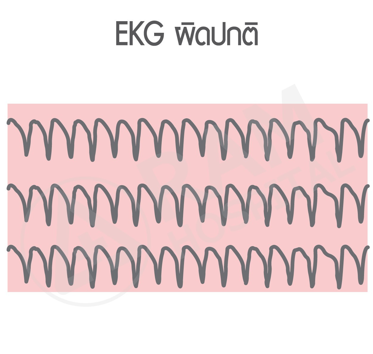 ตรวจคลื่นไฟฟ้าหัวใจ