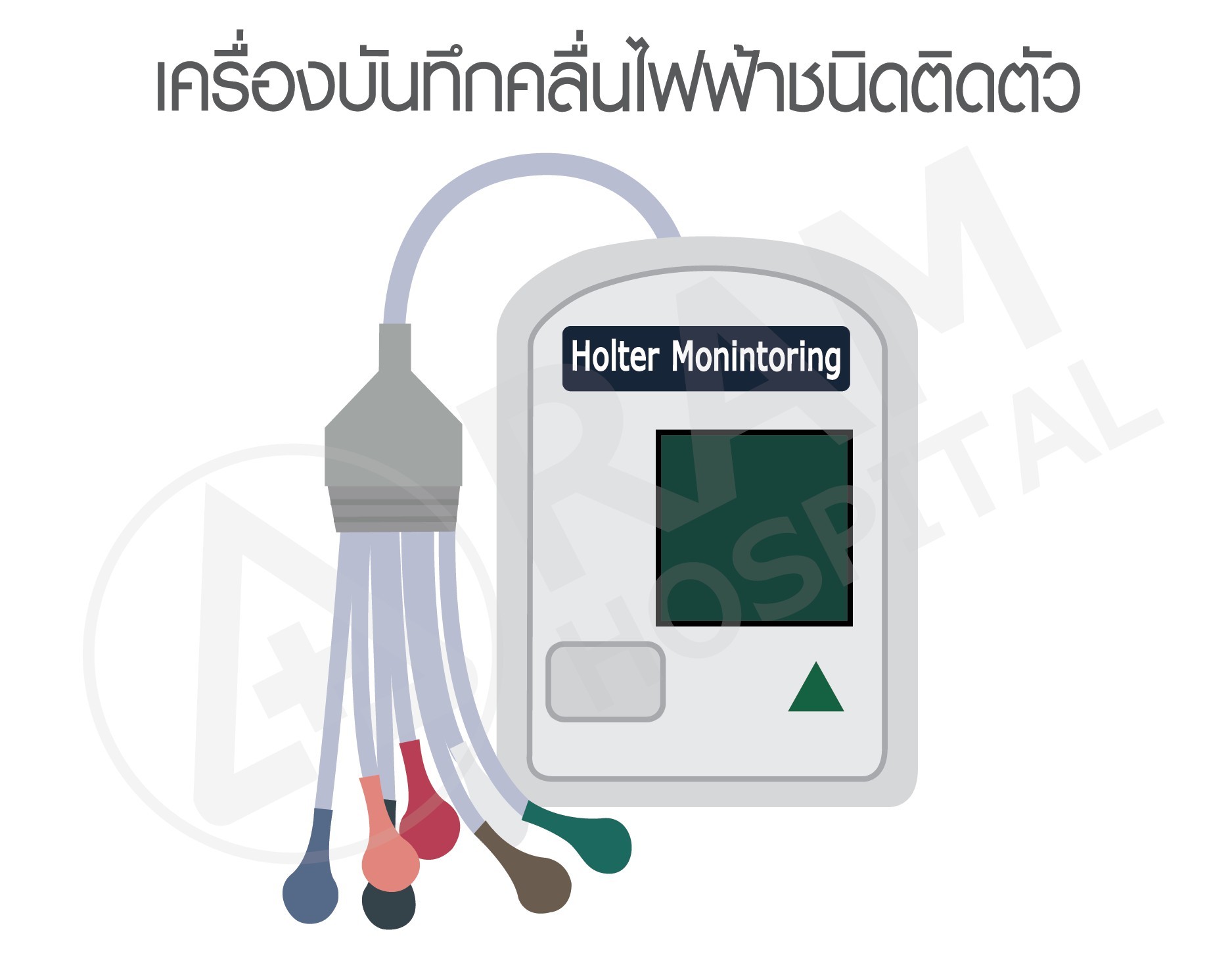 ตรวจคลื่นไฟฟ้าหัวใจ