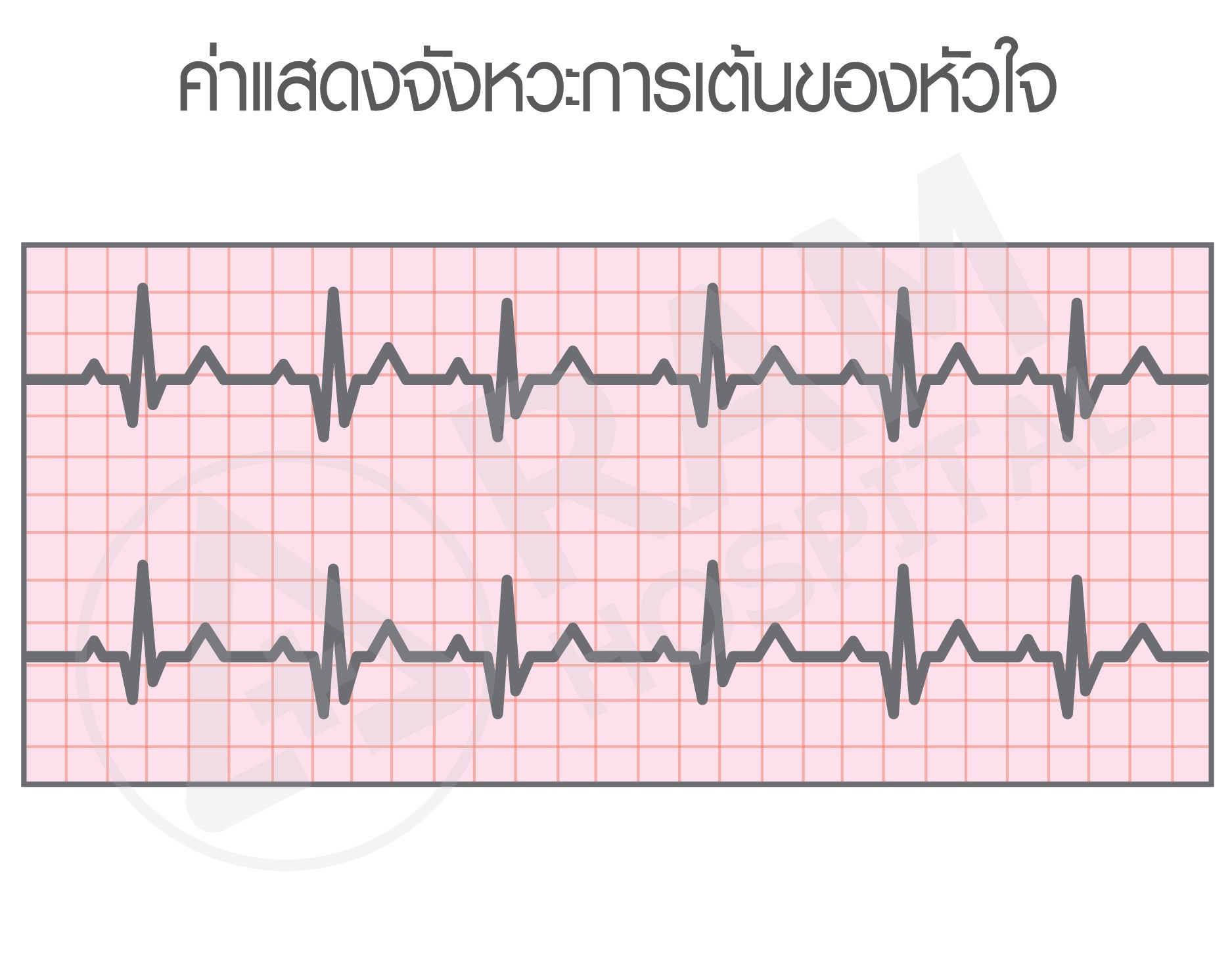 ตรวจคลื่นไฟฟ้าหัวใจ