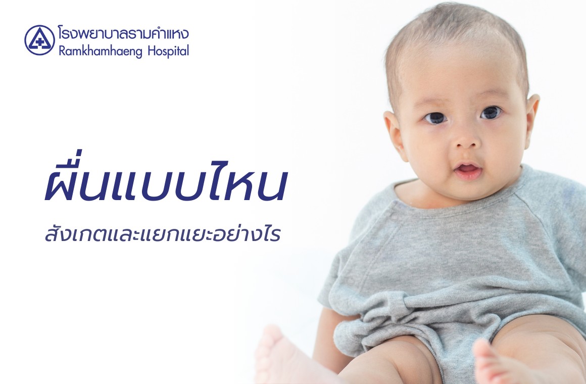 ผื่นในเด็ก