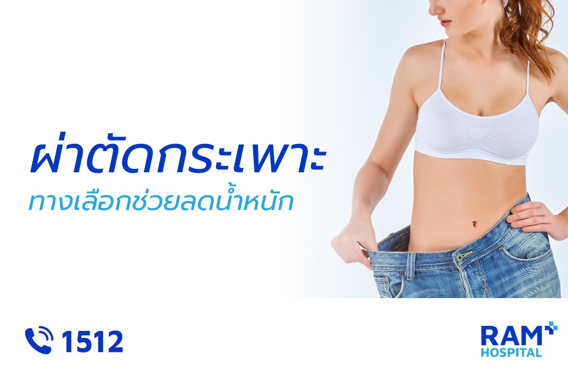 ผ่าตัดกระเพาะอาหาร