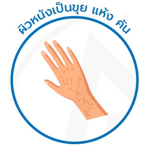 Diabetic foot ulcers
