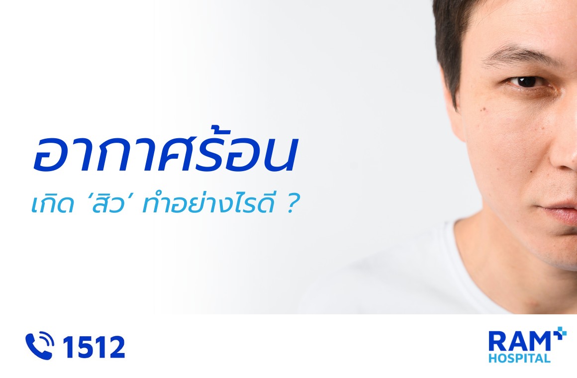 สิว หน้าร้อน