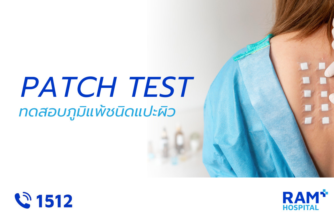 ทดสอบภูมิแพ้