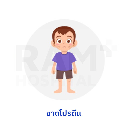 สมองเสื่อม อาหาร