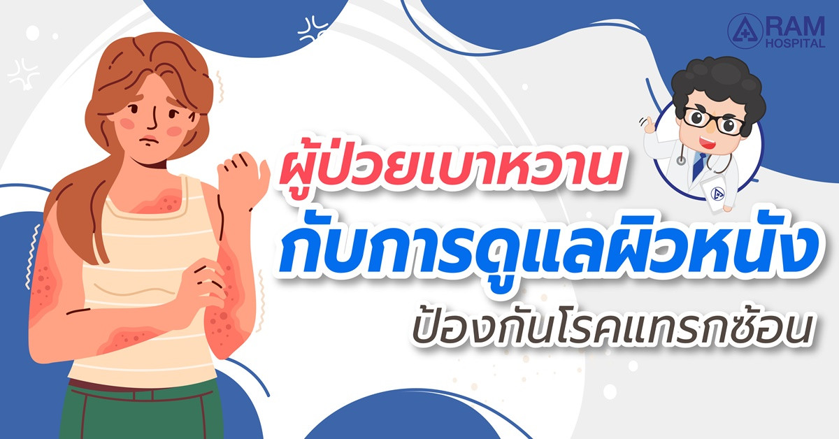 เบาหวาน ป้องกัน