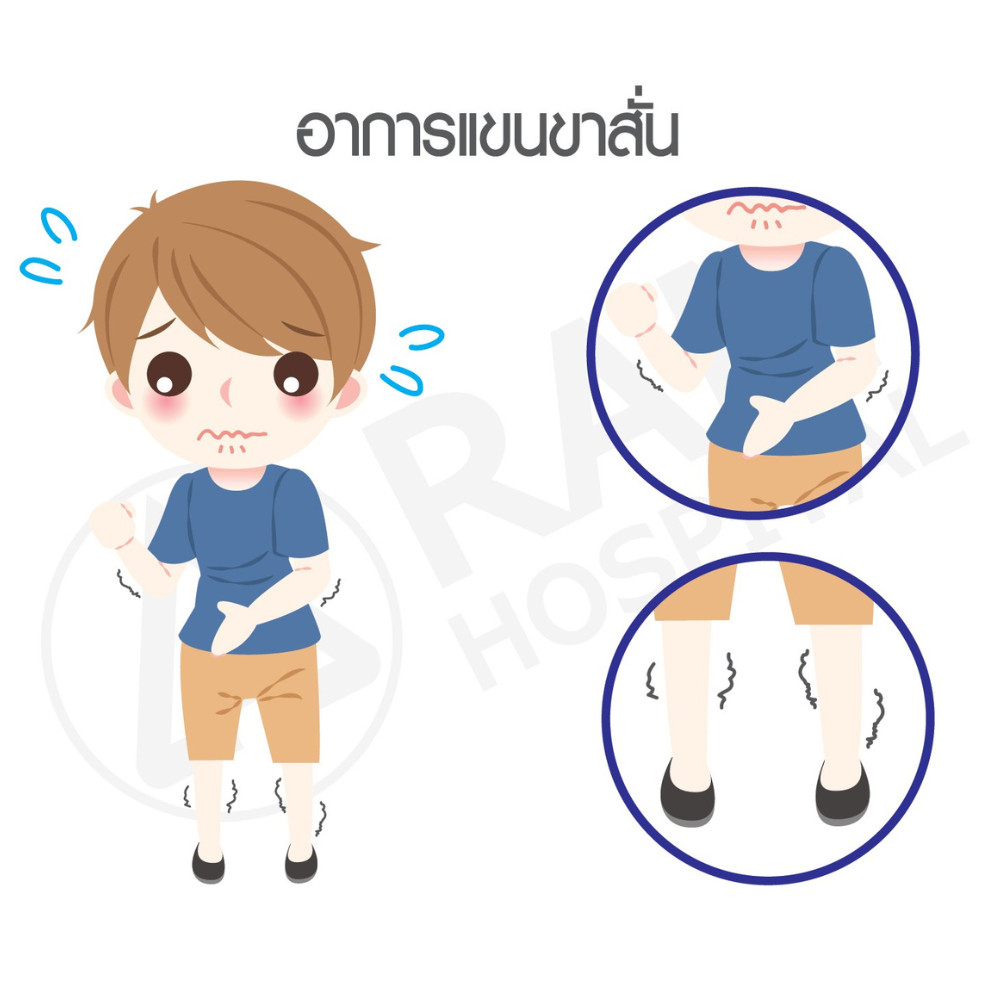 น้ำคั่งในโพรงสมอง