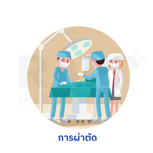 ต้อหิน