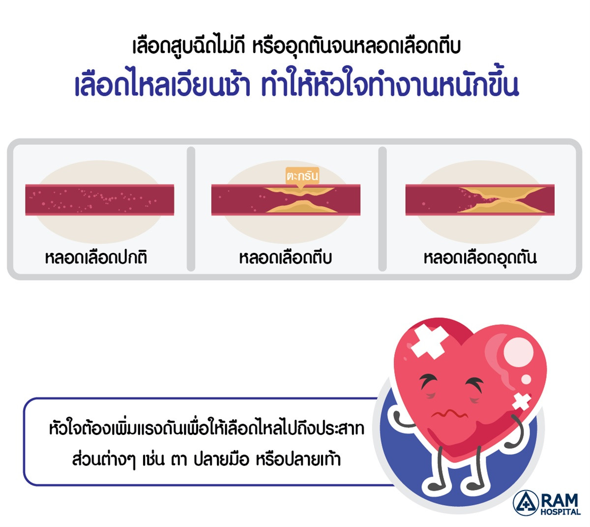 แผลเบาหวาน