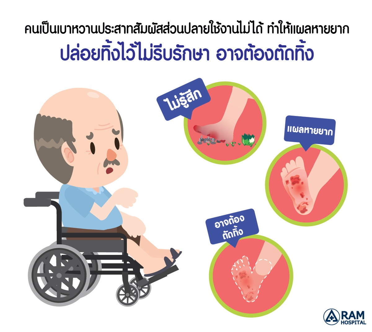 แผลเบาหวาน