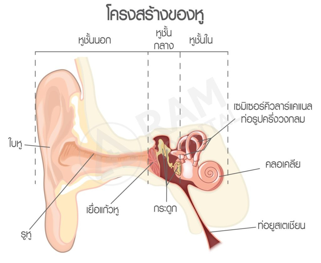 โรคหินปูนในหูชั้นใน