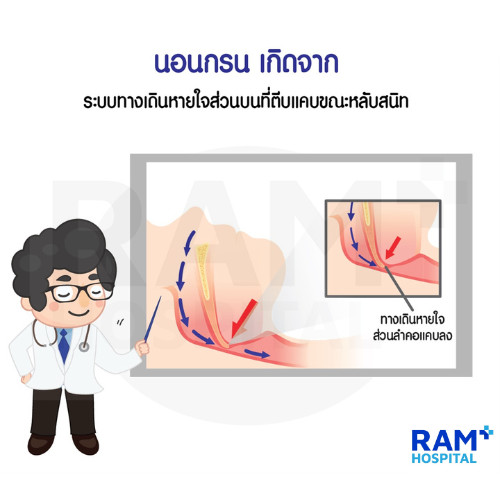 นอนกรน