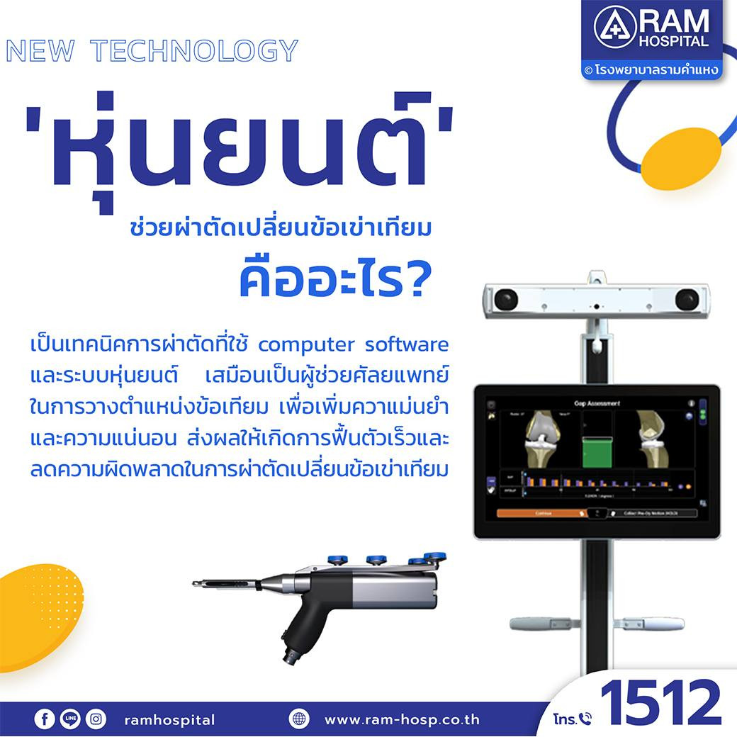 ผ่าตัดข้อเข่าเทียมด้วยหุ่นยนต์
