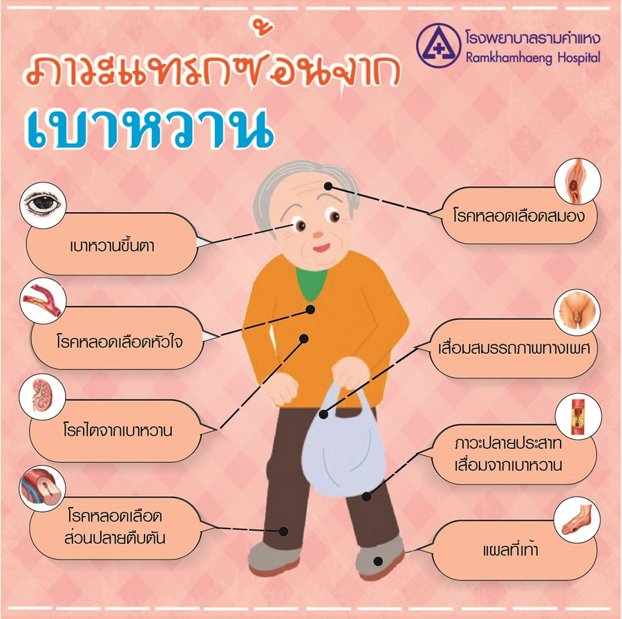 โรคเบาหวาน