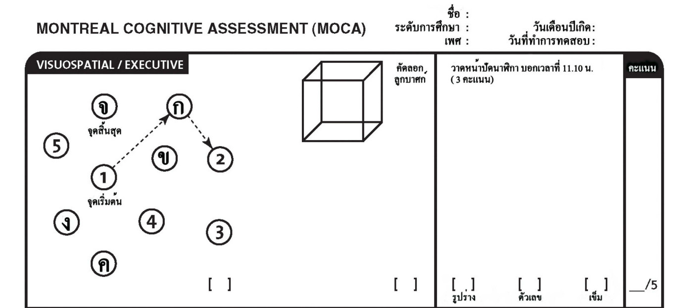 โรคสมองเสื่อม ตรวจ