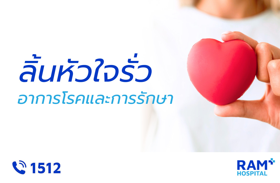 ลิ้นหัวใจรั่ว