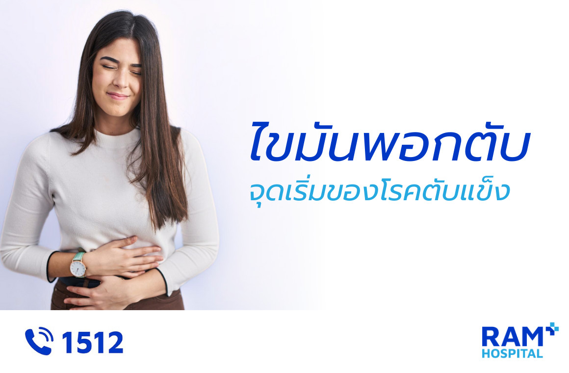 ไขมันพอกตับ
