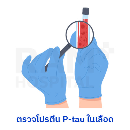 โรคสมองเสื่อม