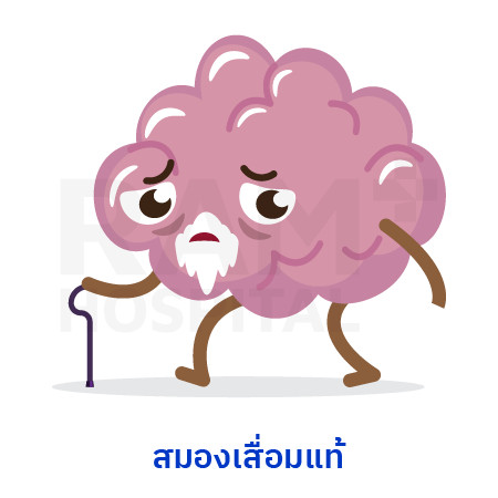 โรคสมองเสื่อม