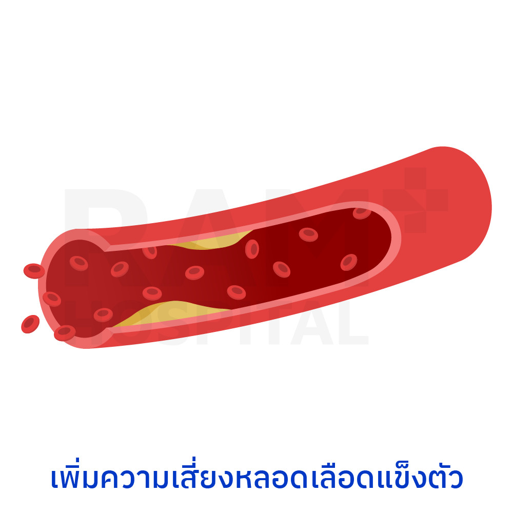 tmao สมองเสื่อม