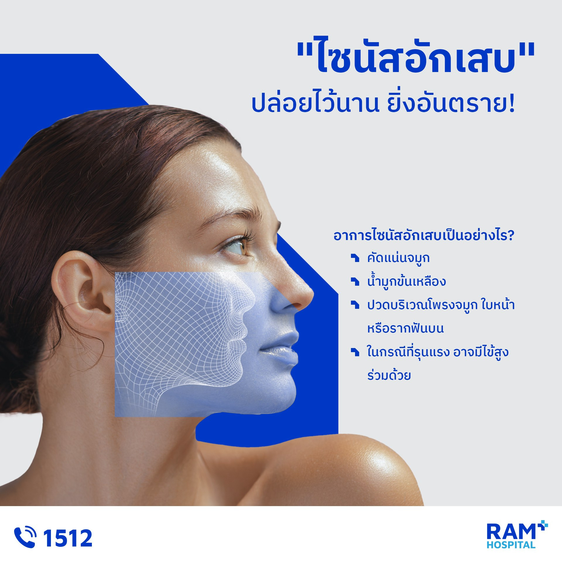 ไซนัสอักเสบ