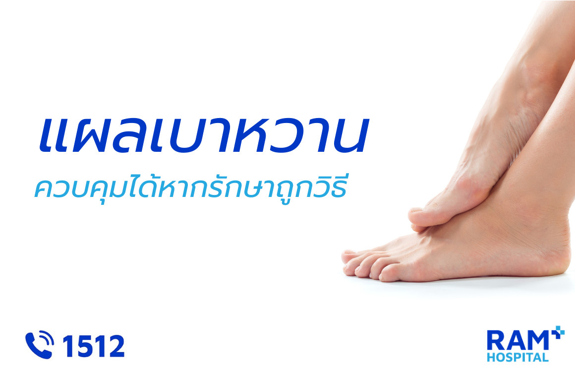 แผลเบาหวาน การดูแล