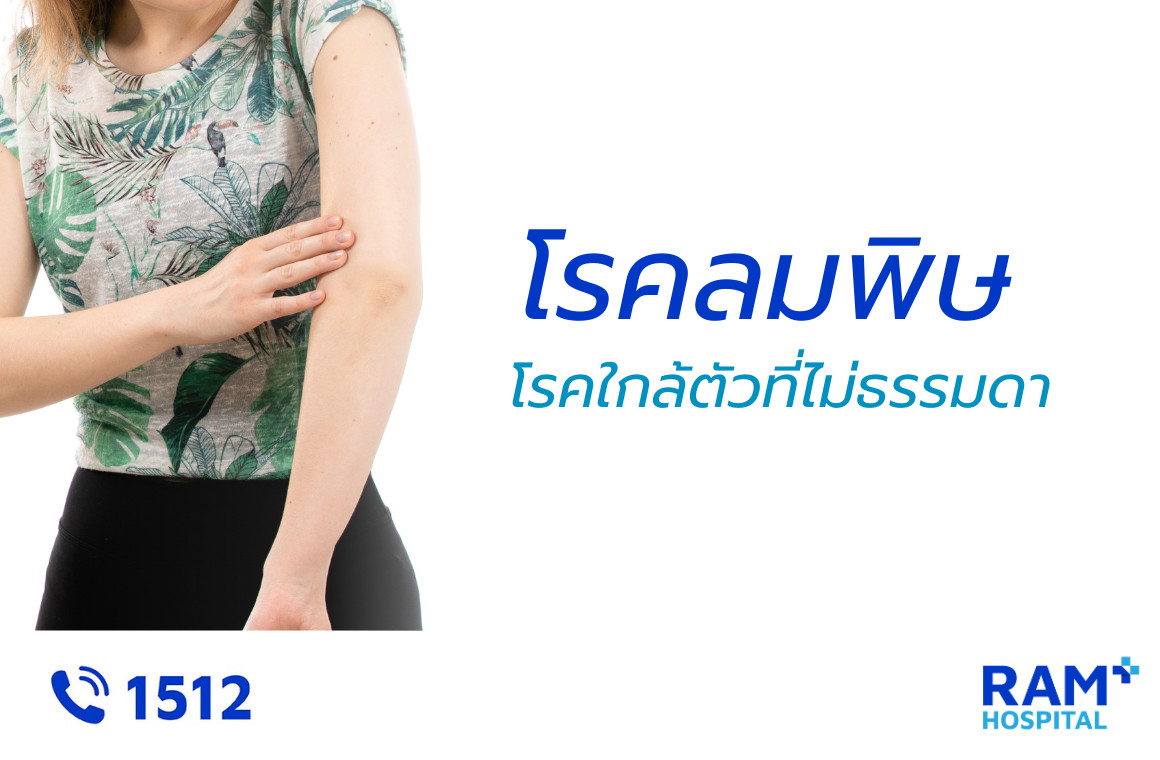 โรคลมพิษ