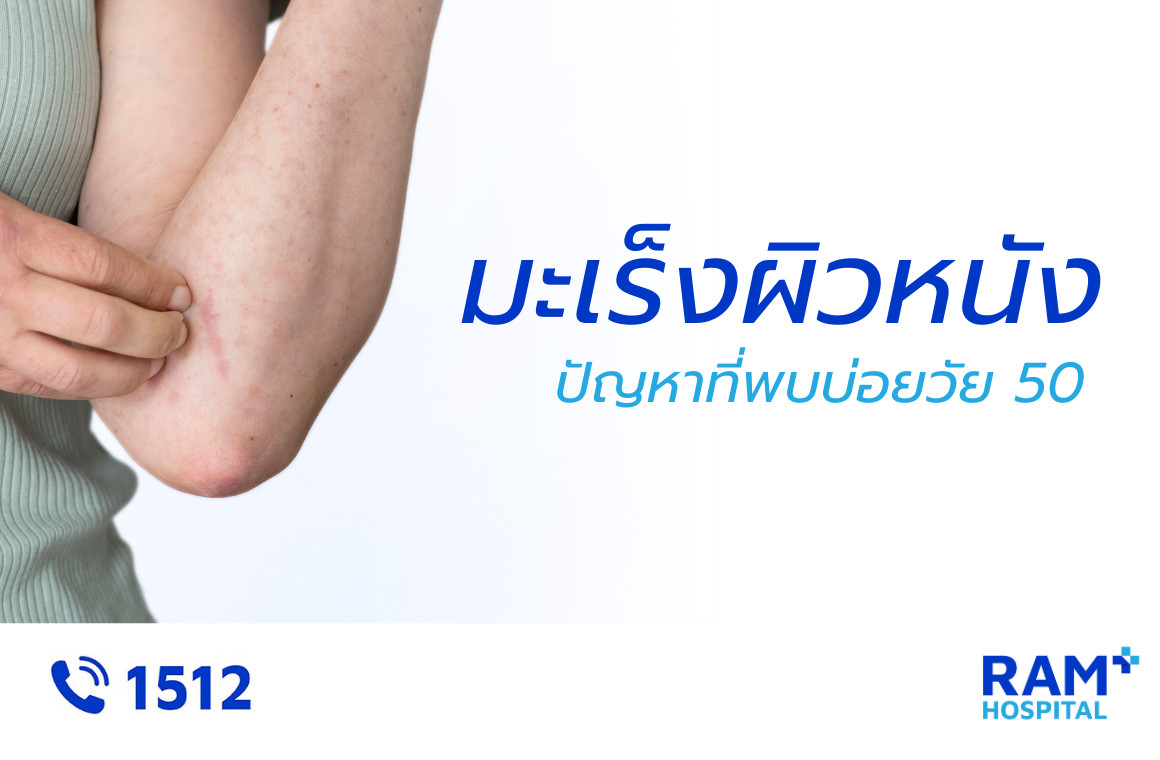 มะเร็งผิวหนัง