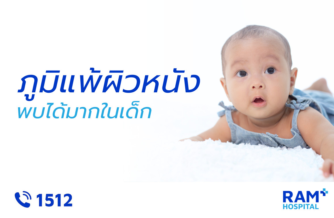 ผื่นภูมิแพ้ผิวหนัง